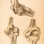 1823 Astley Cooper Medicine & Surgery Orthopedic Joint Dislocations Fractures