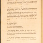 1823 Astley Cooper Medicine & Surgery Orthopedic Joint Dislocations Fractures